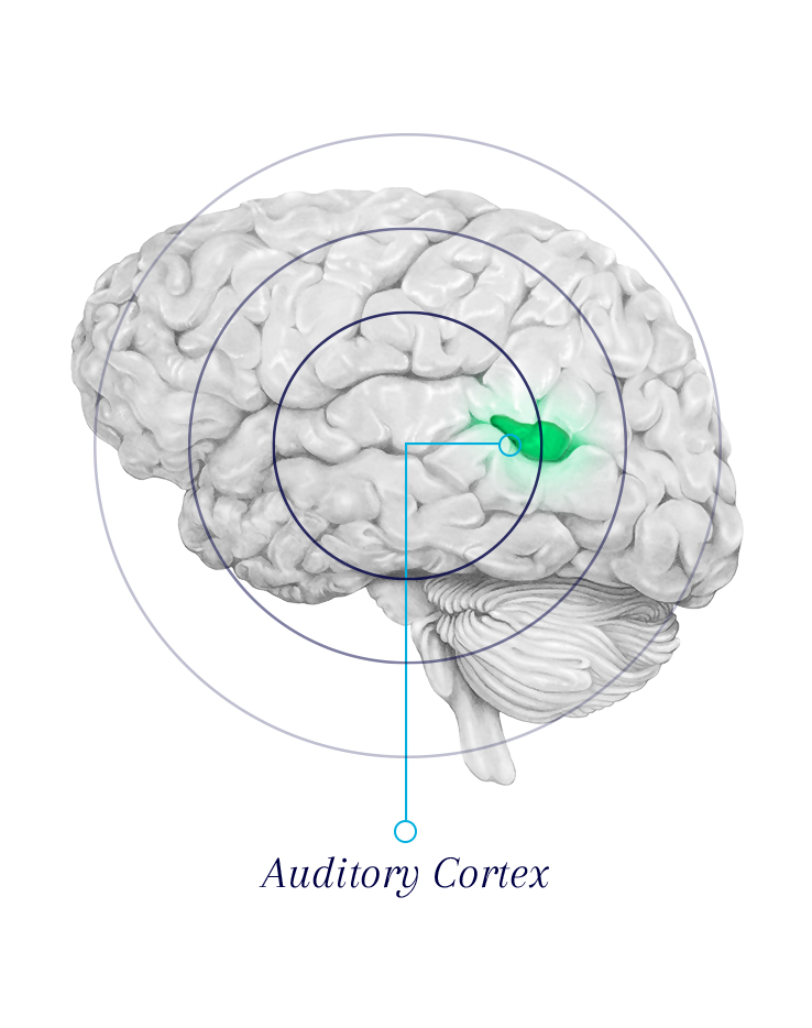 Tinnitus-Audio-Cortex-EN